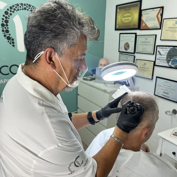 micropigmentación capilar pelo largo