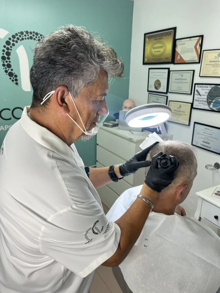 micropigmentacion capilar densidad